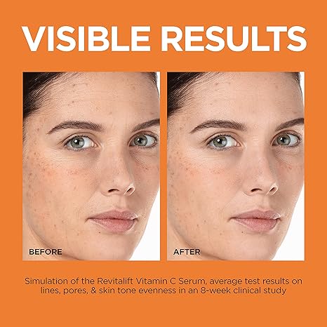 L'Oreal Paris Revitalift Vitamin C serum 12% with E and Salicylic, 30ml