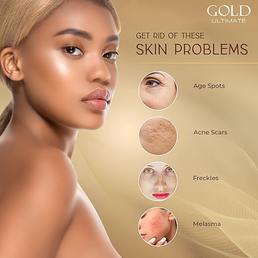 F&W Gold Exceptional Clarifying Cream 200ml skincare product