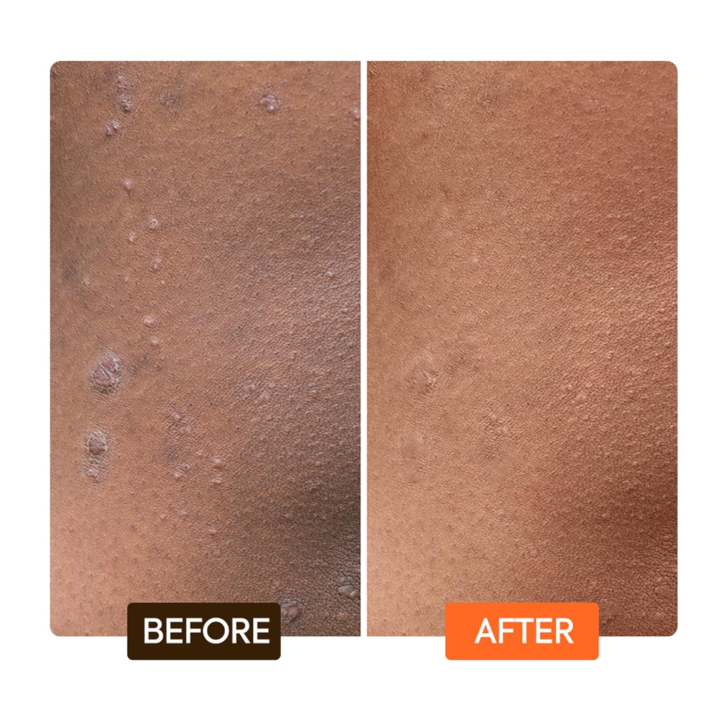 Makari Extreme Argan and Carrot Oil Tone Boosting Gel before and after results