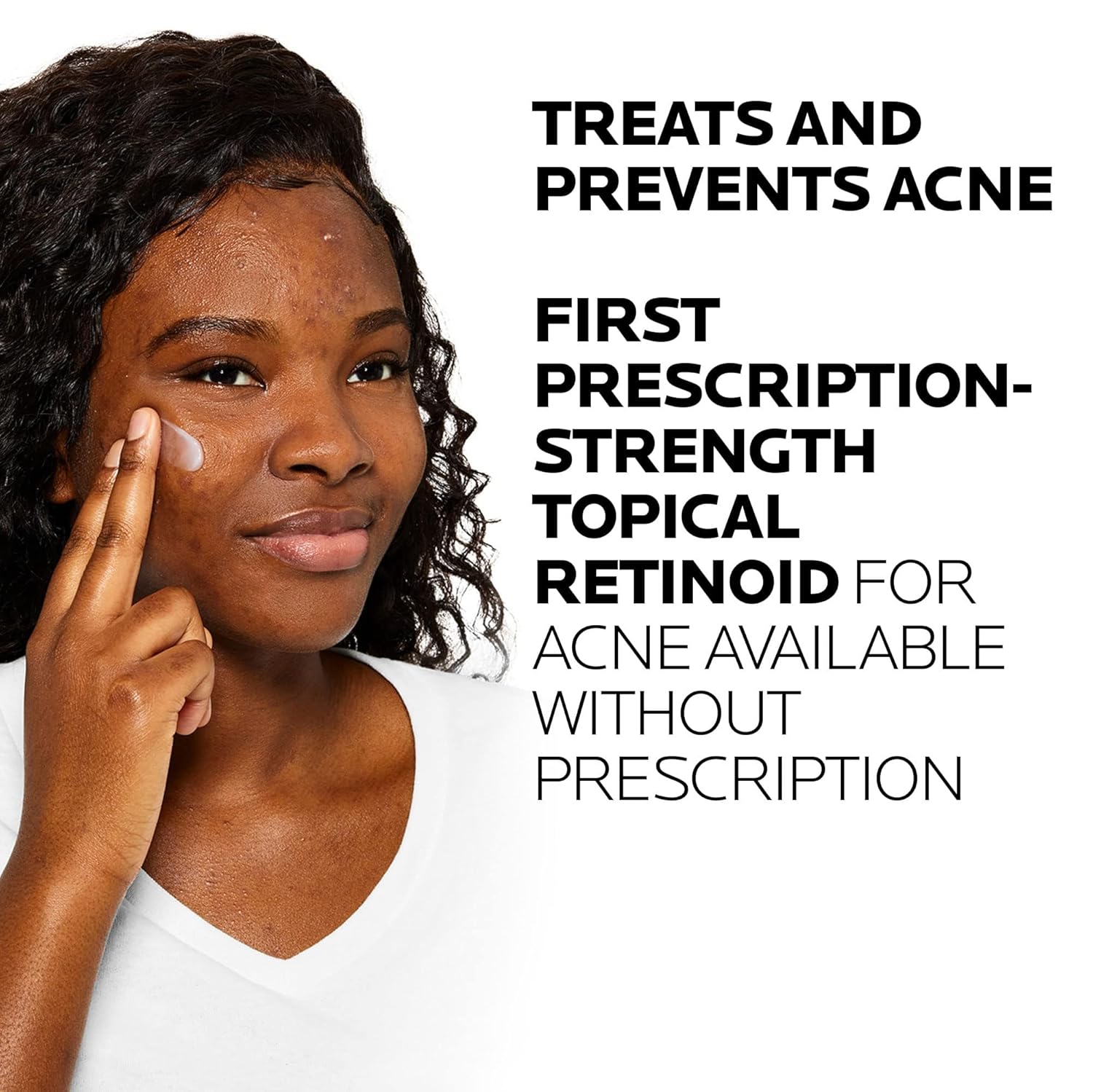 La Roche-Posay Effaclar Adapalene Gel 0.1% acne treatment retinoid topical
