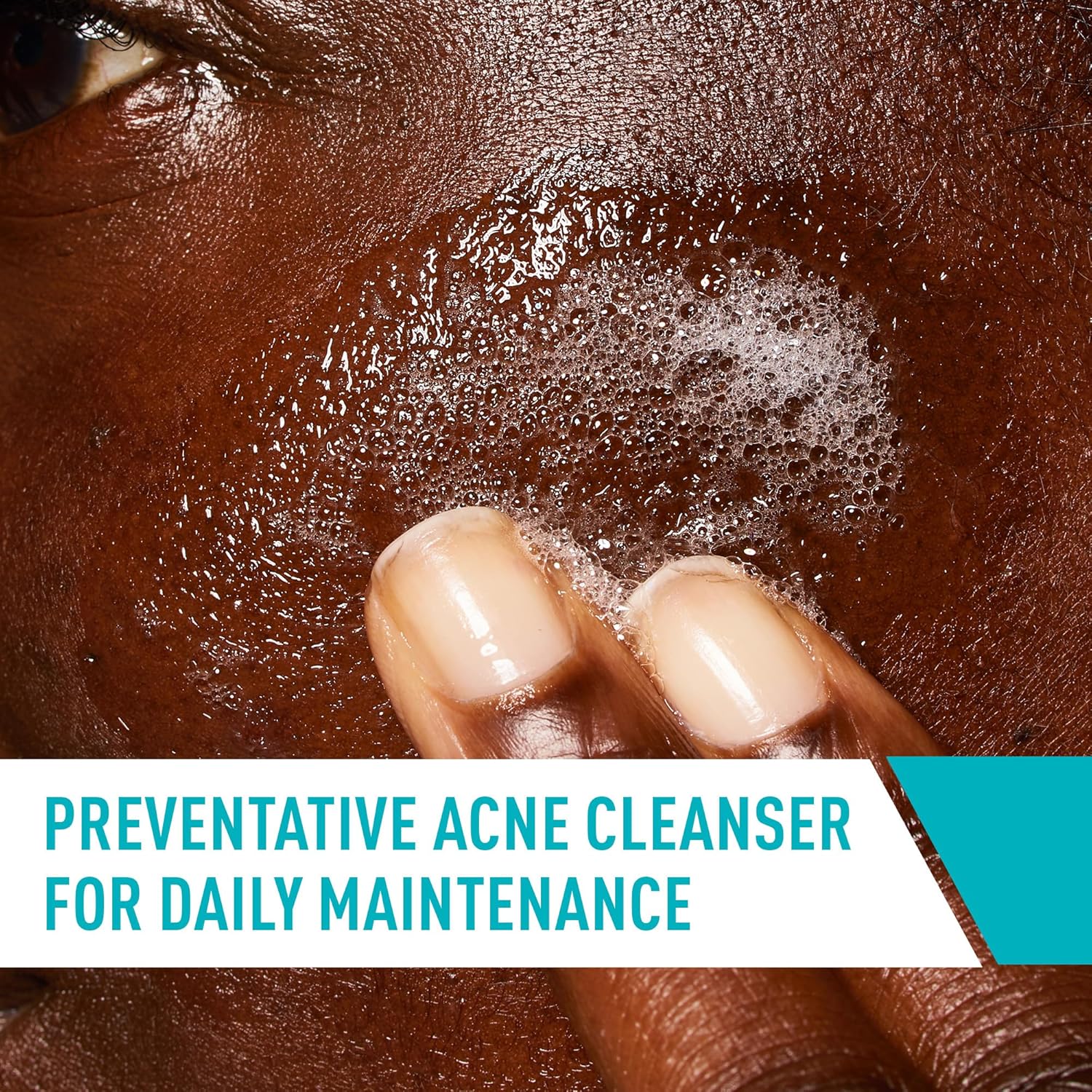 CeraVe Acne Control Cleanser 473 ml bottle for daily facial cleansing