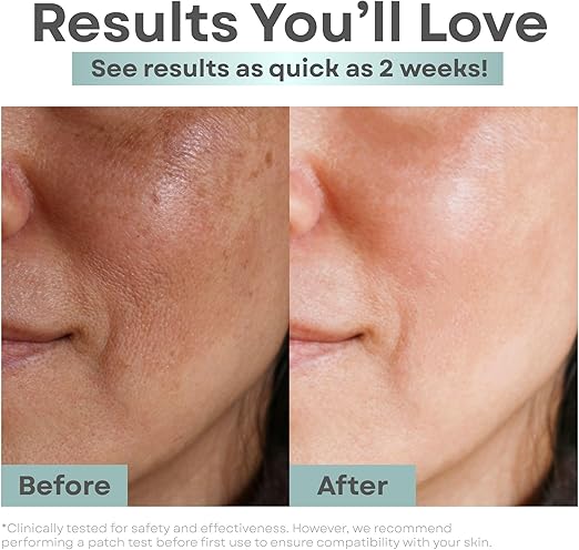 Clear Essence Anti Aging Toner Astringent with Alpha Hydroxy Acid 8 oz bottle