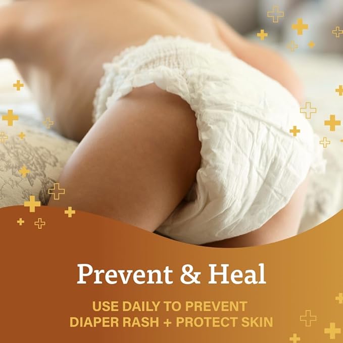 A+D Original Ointment 1.5oz diaper rash and skin protectant cream